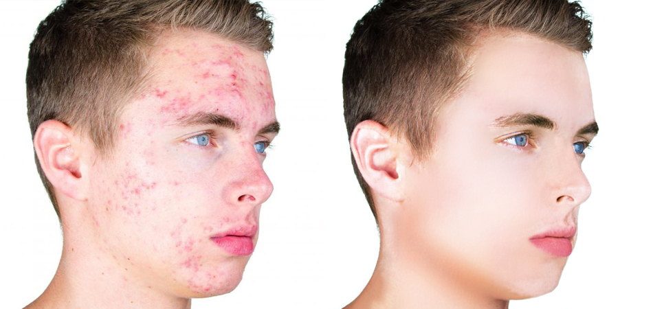 Spot Retouching